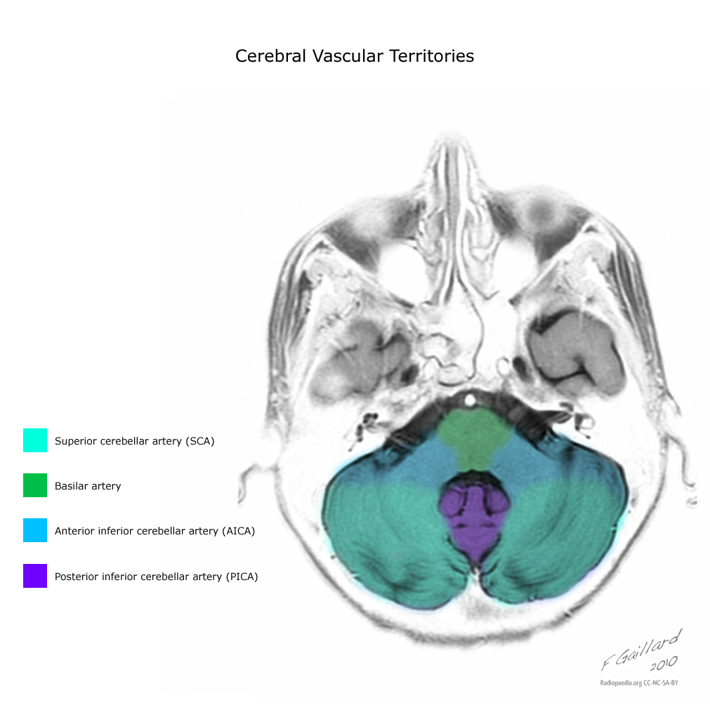 Vascolarizzazione cerebrale in fossa cranica posteriore